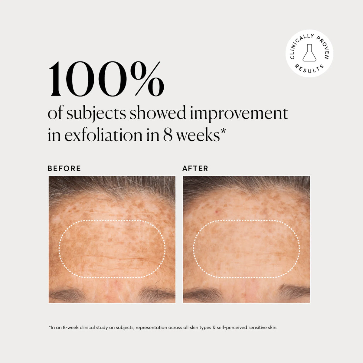 bha-liquid-exfoliant-2-r7 NATR-10027-Alt-Images-BHA-Liquid-Exfoliant-2_-03.webp